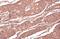 Ribonucleotide Reductase Catalytic Subunit M1 antibody, GTX100758, GeneTex, Immunohistochemistry paraffin image 