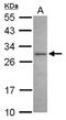 Nuclear Receptor Binding Protein 2 antibody, NBP2-19585, Novus Biologicals, Western Blot image 