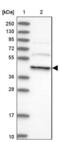 Dynactin Subunit 4 antibody, NBP2-38378, Novus Biologicals, Western Blot image 