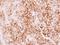 Creatine Kinase, Mitochondrial 1B antibody, GTX112264, GeneTex, Immunohistochemistry paraffin image 