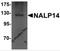 NLR Family Pyrin Domain Containing 14 antibody, 5975, ProSci, Western Blot image 