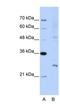 Exosome Component 4 antibody, NBP1-57180, Novus Biologicals, Western Blot image 