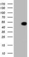 Vascular Endothelial Growth Factor D antibody, TA807495, Origene, Western Blot image 