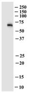 Solute Carrier Family 22 Member 4 antibody, H00006583-M01, Novus Biologicals, Western Blot image 