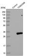 Transmembrane Protein 38B antibody, PA5-53809, Invitrogen Antibodies, Western Blot image 