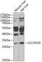 Mitochondrial carnitine/acylcarnitine carrier protein antibody, 22-526, ProSci, Western Blot image 
