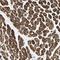 Troponin T2, Cardiac Type antibody, NBP1-88069, Novus Biologicals, Immunohistochemistry frozen image 