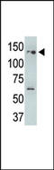 Ubiquitin Specific Peptidase 25 antibody, AP12045PU-N, Origene, Western Blot image 