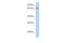 Zinc Finger Protein 676 antibody, PA5-43543, Invitrogen Antibodies, Western Blot image 