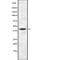 NPHS2 Stomatin Family Member, Podocin antibody, abx217842, Abbexa, Western Blot image 