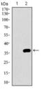 Neuronal Cell Adhesion Molecule antibody, GTX60770, GeneTex, Western Blot image 