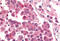 Cyclin Dependent Kinase 12 antibody, MBS243508, MyBioSource, Immunohistochemistry frozen image 