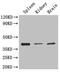 Lysosomal Associated Membrane Protein 2 antibody, A50330-100, Epigentek, Western Blot image 