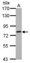 Glutamine-Fructose-6-Phosphate Transaminase 2 antibody, NBP2-16649, Novus Biologicals, Western Blot image 