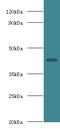 Haptoglobin antibody, LS-B14985, Lifespan Biosciences, Western Blot image 