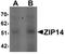 Solute Carrier Family 39 Member 14 antibody, NBP1-76510, Novus Biologicals, Western Blot image 