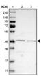 Elongator Acetyltransferase Complex Subunit 5 antibody, NBP1-85250, Novus Biologicals, Western Blot image 