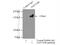 Zinc Finger MYND-Type Containing 8 antibody, 11633-1-AP, Proteintech Group, Immunoprecipitation image 