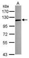 Toll Like Receptor 5 antibody, GTX102706, GeneTex, Western Blot image 