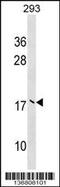 Ubiquitin Conjugating Enzyme E2 V2 antibody, 59-027, ProSci, Western Blot image 