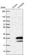 Synaptogyrin 4 antibody, PA5-56331, Invitrogen Antibodies, Western Blot image 