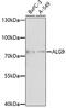 ALG9 Alpha-1,2-Mannosyltransferase antibody, 16-885, ProSci, Western Blot image 