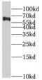 Solute Carrier Family 37 Member 2 antibody, FNab07957, FineTest, Western Blot image 