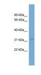 Lysine Rich Coiled-Coil 1 antibody, NBP1-79654, Novus Biologicals, Western Blot image 