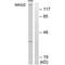 Membrane Associated Guanylate Kinase, WW And PDZ Domain Containing 2 antibody, PA5-49843, Invitrogen Antibodies, Western Blot image 