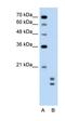 Ubiquitin Conjugating Enzyme E2 L3 antibody, orb330276, Biorbyt, Western Blot image 