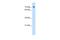 Solute Carrier Family 5 Member 11 antibody, PA5-69282, Invitrogen Antibodies, Western Blot image 