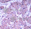 Phosphatase And Tensin Homolog antibody, AP0436, ABclonal Technology, Immunohistochemistry paraffin image 