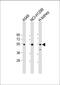 Glucosaminyl (N-Acetyl) Transferase 3, Mucin Type antibody, 58-761, ProSci, Western Blot image 