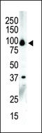 Protein Kinase D3 antibody, MBS9204329, MyBioSource, Western Blot image 