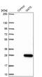 Putative protein GATS antibody, PA5-60271, Invitrogen Antibodies, Western Blot image 