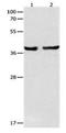 Serpin Family B Member 5 antibody, orb107412, Biorbyt, Western Blot image 