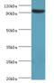 Semaphorin 4C antibody, LS-B15166, Lifespan Biosciences, Western Blot image 