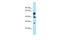 Lysophosphatidylglycerol Acyltransferase 1 antibody, A13705, Boster Biological Technology, Western Blot image 