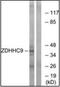 Zinc Finger DHHC-Type Containing 9 antibody, orb96599, Biorbyt, Western Blot image 