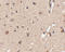 Autophagy Related 12 antibody, A00820, Boster Biological Technology, Immunohistochemistry paraffin image 