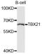 T-box transcription factor TBX21 antibody, LS-B14387, Lifespan Biosciences, Western Blot image 