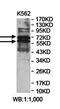 Zinc Finger Protein 274 antibody, orb78384, Biorbyt, Western Blot image 