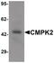 Cytidine/Uridine Monophosphate Kinase 2 antibody, PA5-34461, Invitrogen Antibodies, Western Blot image 