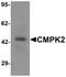 Cytidine/Uridine Monophosphate Kinase 2 antibody, PA5-34461, Invitrogen Antibodies, Western Blot image 