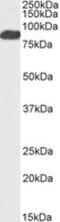 Forkhead Box P2 antibody, NBP1-51907, Novus Biologicals, Western Blot image 