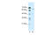 Acid Sensing Ion Channel Subunit 2 antibody, 28-231, ProSci, Western Blot image 