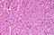 Syntaxin 18 antibody, MBS246354, MyBioSource, Immunohistochemistry paraffin image 