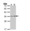 V-type proton ATPase subunit E 1 antibody, NBP2-15519, Novus Biologicals, Western Blot image 