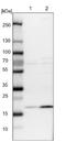 Transmembrane Protein 199 antibody, NBP1-88467, Novus Biologicals, Western Blot image 
