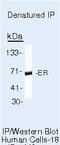 Estrogen Receptor 2 antibody, MA5-13304, Invitrogen Antibodies, Immunoprecipitation image 